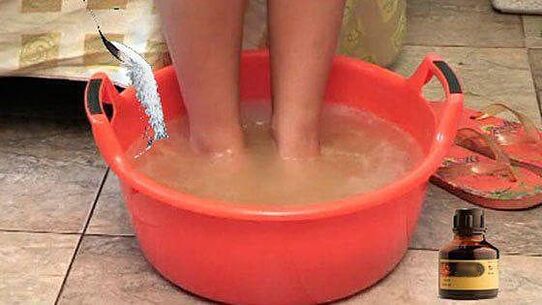 Taking a hot bath with iodine is one of the steps in the treatment of toenail fungus