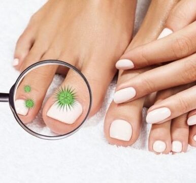 Nail infection by magnifying glass