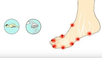 Reasons for fungi to the toes