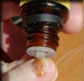 Applying drops to a toenail affected by fungus
