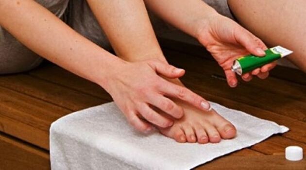 treatment of toenail fungus with ointment